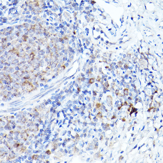 BOK Antibody in Immunohistochemistry (Paraffin) (IHC (P))