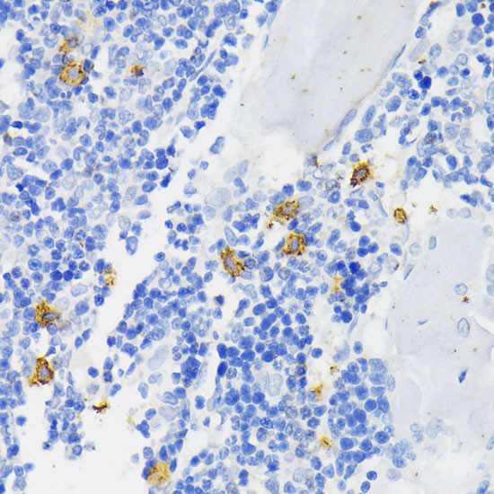 NOX2 Antibody in Immunohistochemistry (Paraffin) (IHC (P))