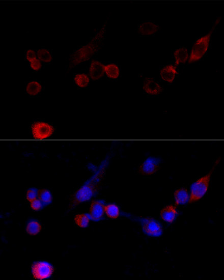 Filamin A Antibody in Immunocytochemistry (ICC/IF)