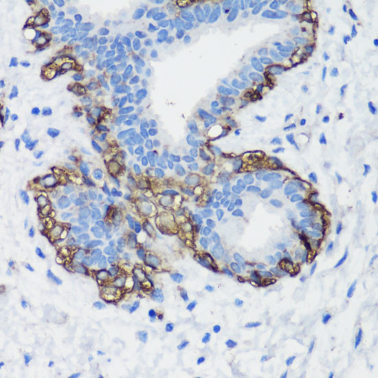 Filamin A Antibody in Immunohistochemistry (Paraffin) (IHC (P))