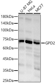 GPD2 Antibody in Western Blot (WB)