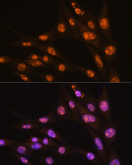 YY2 Antibody in Immunocytochemistry (ICC/IF)