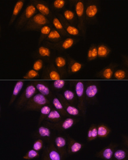 YY2 Antibody in Immunocytochemistry (ICC/IF)