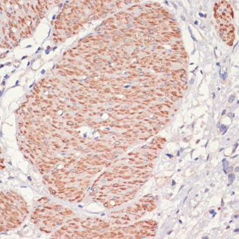 AMPK alpha-1 Antibody in Immunohistochemistry (Paraffin) (IHC (P))