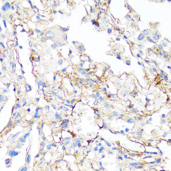 Fibronectin Antibody in Immunohistochemistry (Paraffin) (IHC (P))