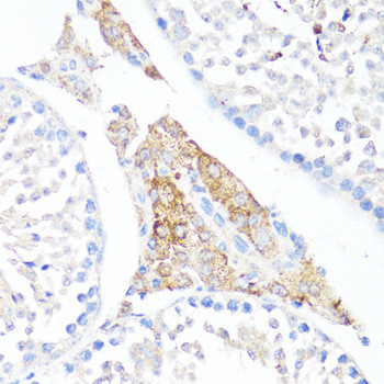 Fibronectin Antibody in Immunohistochemistry (Paraffin) (IHC (P))