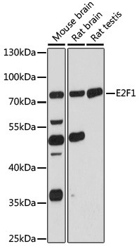 E2F1 Antibody in Western Blot (WB)