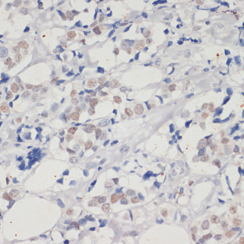 DNMT1 Antibody in Immunohistochemistry (Paraffin) (IHC (P))