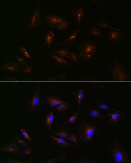 ABCA2 Antibody in Immunocytochemistry (ICC/IF)