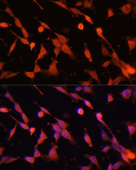 Caspase 3 Antibody in Immunocytochemistry (ICC/IF)