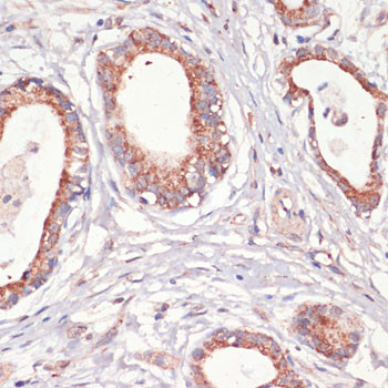 Caspase 3 Antibody in Immunohistochemistry (Paraffin) (IHC (P))