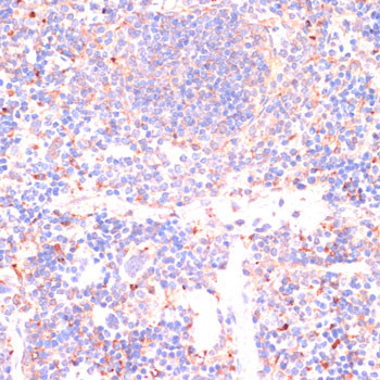 Caspase 3 Antibody in Immunohistochemistry (Paraffin) (IHC (P))