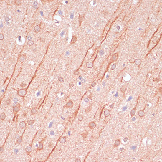 SAP102 Antibody in Immunohistochemistry (Paraffin) (IHC (P))