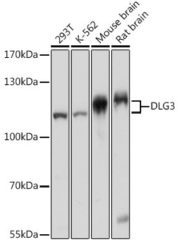 SAP102 Antibody in Western Blot (WB)