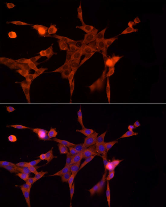 AKR1B1 Antibody in Immunocytochemistry (ICC/IF)