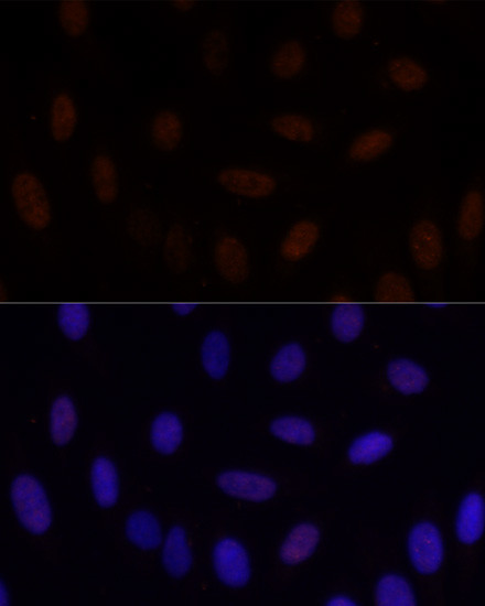 GLI2 Antibody in Immunocytochemistry (ICC/IF)