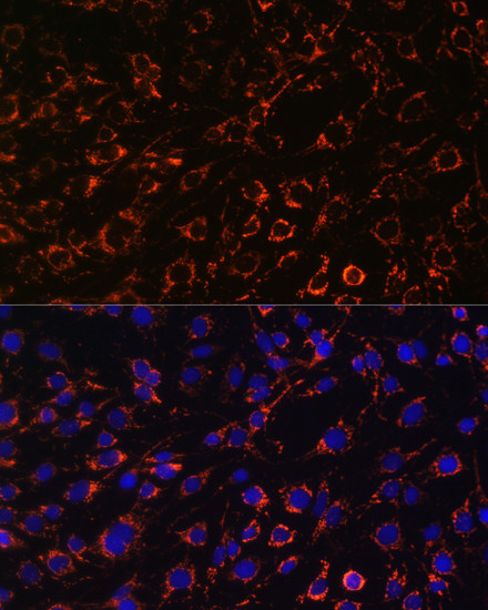 TOMM20 Antibody in Immunocytochemistry (ICC/IF)