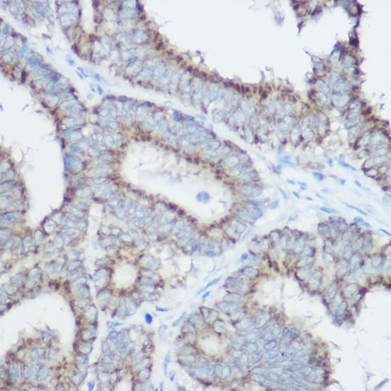 TOMM20 Antibody in Immunohistochemistry (Paraffin) (IHC (P))