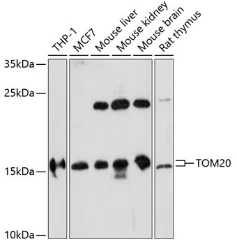 TOMM20 Antibody in Western Blot (WB)