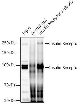 INSR Antibody in Immunoprecipitation (IP)