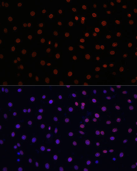 Lamin B1 Antibody in Immunocytochemistry (ICC/IF)