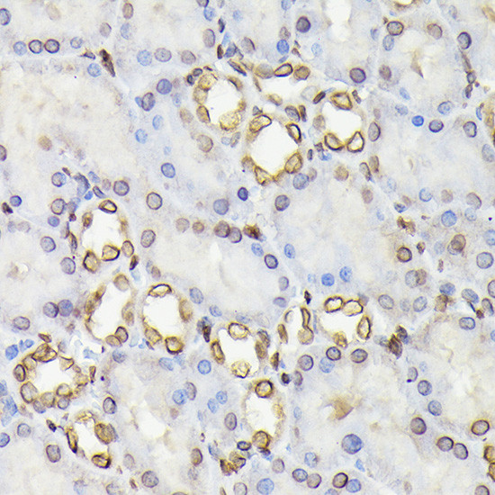 Lamin B1 Antibody in Immunohistochemistry (Paraffin) (IHC (P))