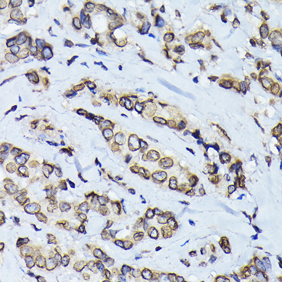 Lamin B1 Antibody in Immunohistochemistry (Paraffin) (IHC (P))