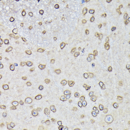 Lamin B1 Antibody in Immunohistochemistry (Paraffin) (IHC (P))