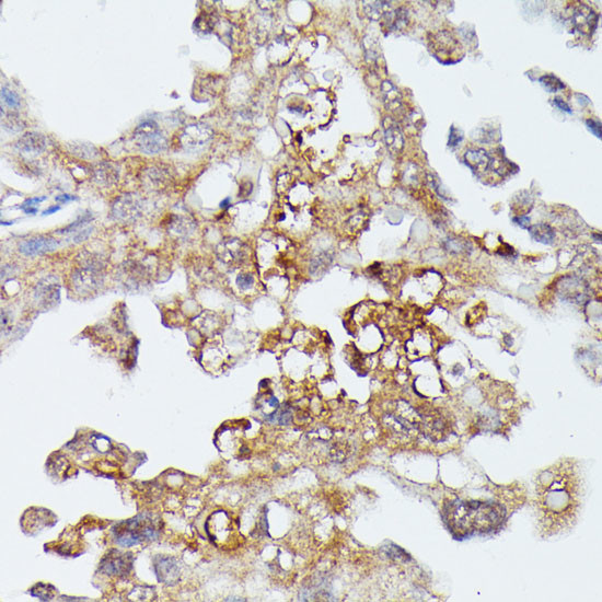 MEKK4 Antibody in Immunohistochemistry (Paraffin) (IHC (P))