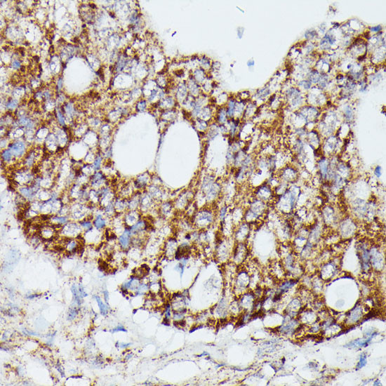 MEKK4 Antibody in Immunohistochemistry (Paraffin) (IHC (P))