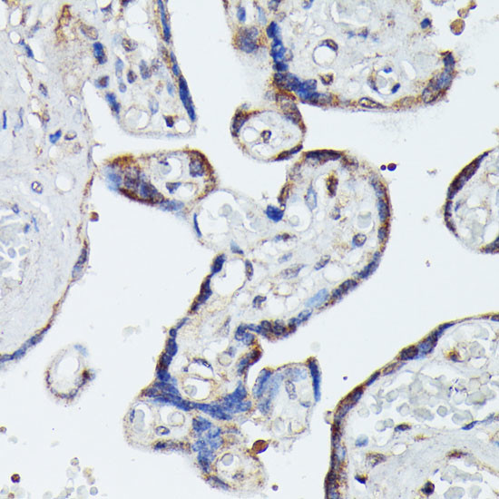 MEKK4 Antibody in Immunohistochemistry (Paraffin) (IHC (P))