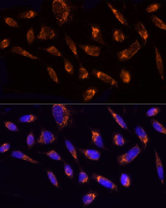 NDUFS1 Antibody in Immunocytochemistry (ICC/IF)