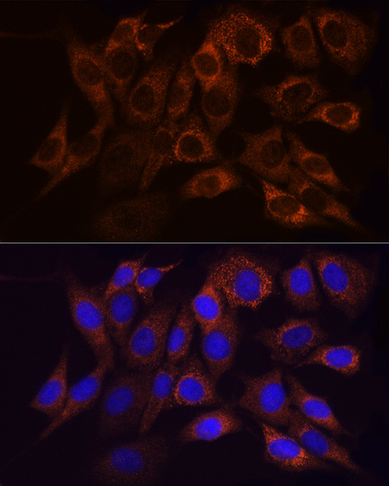 NDUFS1 Antibody in Immunocytochemistry (ICC/IF)