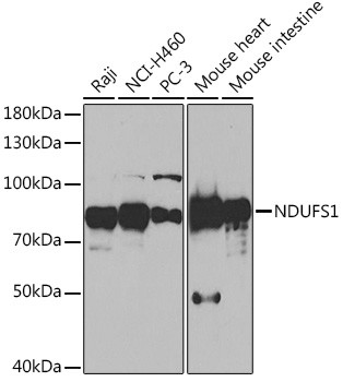 NDUFS1 Antibody in Western Blot (WB)