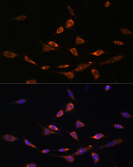 PAK3 Antibody in Immunocytochemistry (ICC/IF)