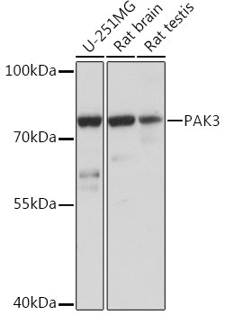 PAK3 Antibody in Western Blot (WB)