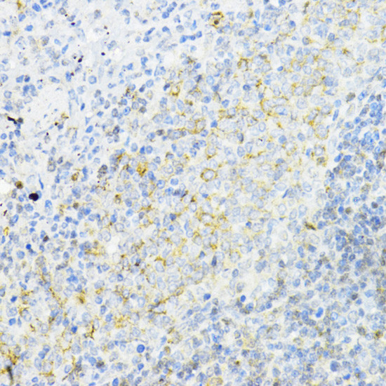 AMPK alpha-1 Antibody in Immunohistochemistry (Paraffin) (IHC (P))