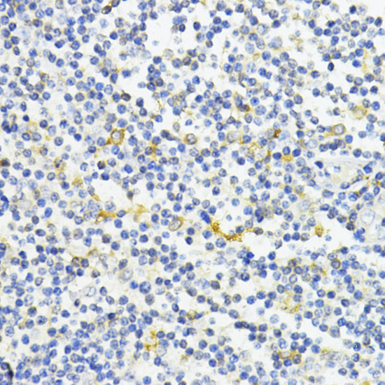 AMPK alpha-1 Antibody in Immunohistochemistry (Paraffin) (IHC (P))