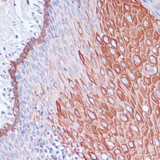 WIPF1 Antibody in Immunohistochemistry (Paraffin) (IHC (P))