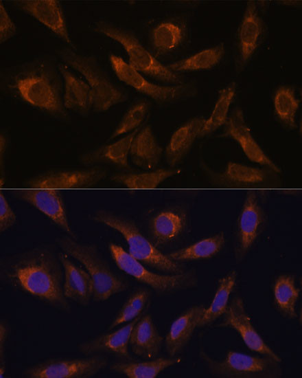 SOCS2 Antibody in Immunocytochemistry (ICC/IF)