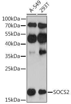 SOCS2 Antibody in Western Blot (WB)