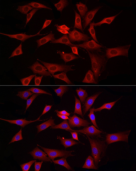 DNM1L Antibody in Immunocytochemistry (ICC/IF)