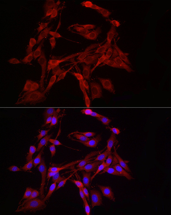 DNM1L Antibody in Immunocytochemistry (ICC/IF)