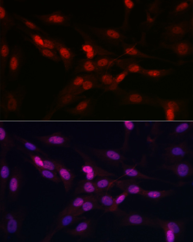 YAP1 Antibody in Immunocytochemistry (ICC/IF)