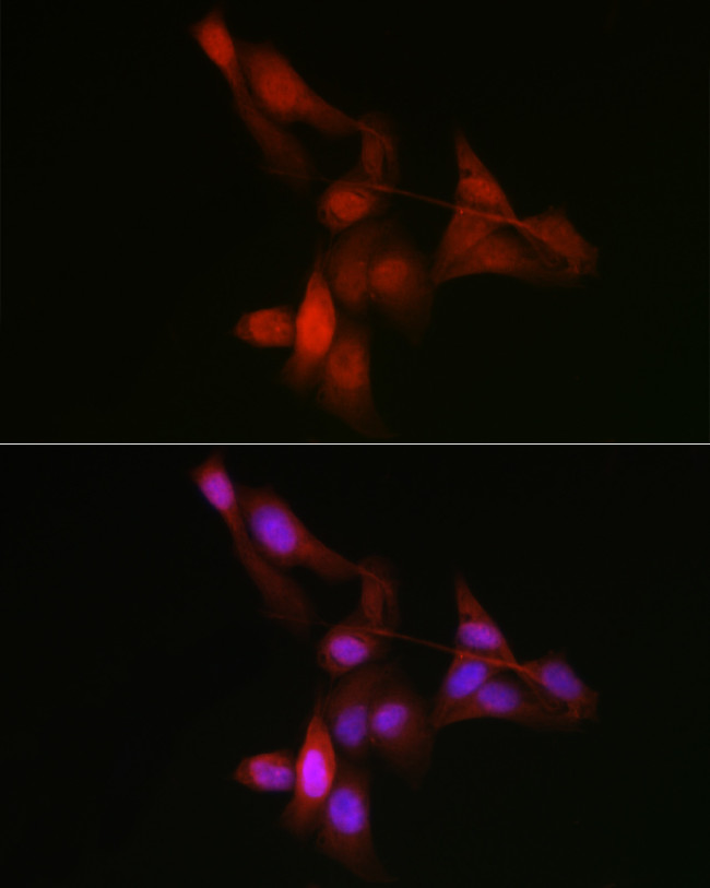 YAP1 Antibody in Immunocytochemistry (ICC/IF)