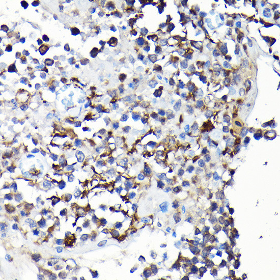 YAP1 Antibody in Immunohistochemistry (Paraffin) (IHC (P))