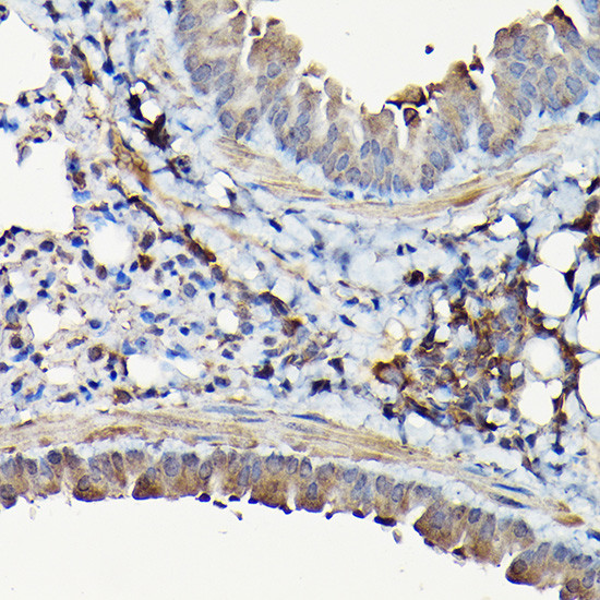 YAP1 Antibody in Immunohistochemistry (Paraffin) (IHC (P))