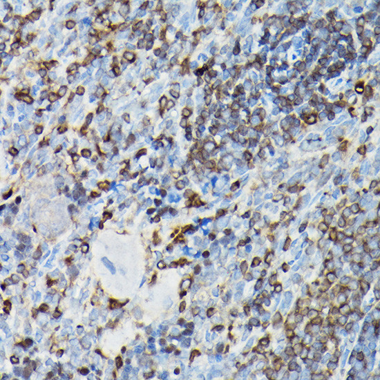 YAP1 Antibody in Immunohistochemistry (Paraffin) (IHC (P))