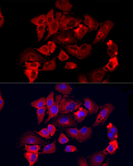 MMP12 Antibody in Immunocytochemistry (ICC/IF)