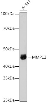 MMP12 Antibody in Western Blot (WB)